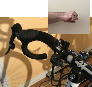 Arm asymmetry